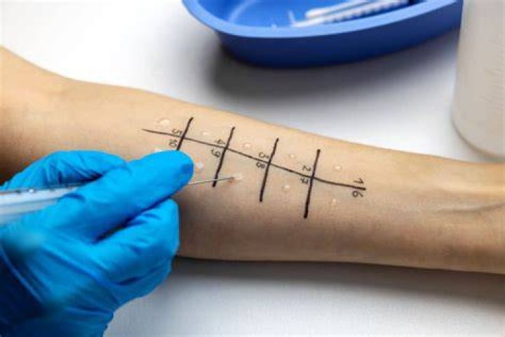 Do ent doctors do allergy testing?