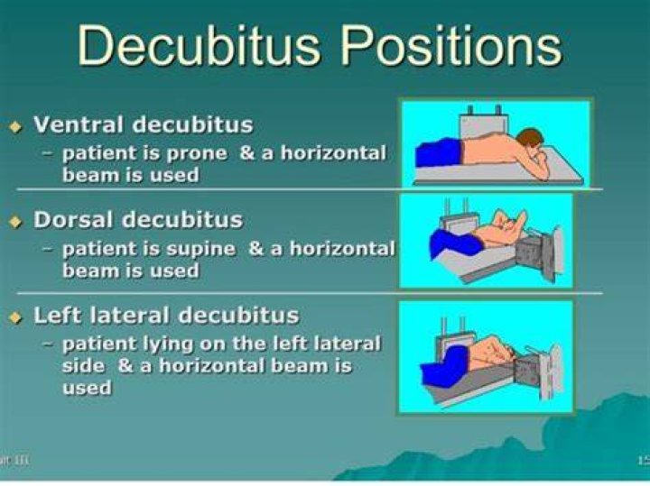 In lateral decubitus position?
