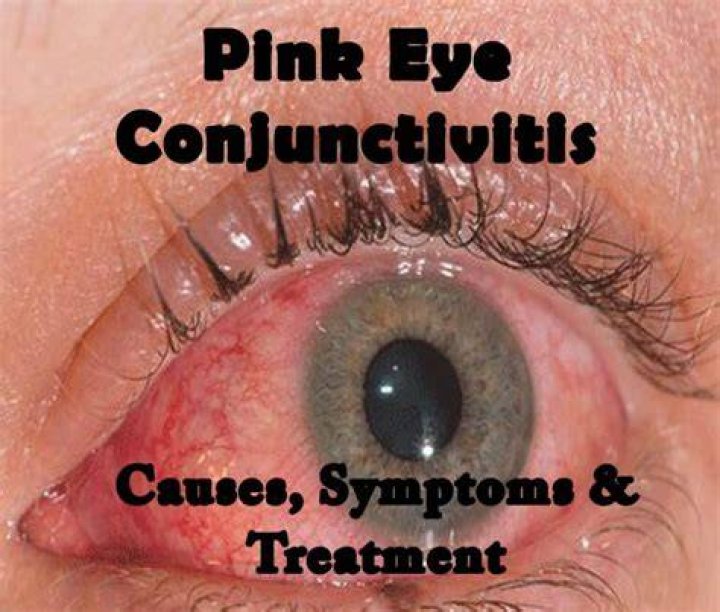 What does pink eye do?