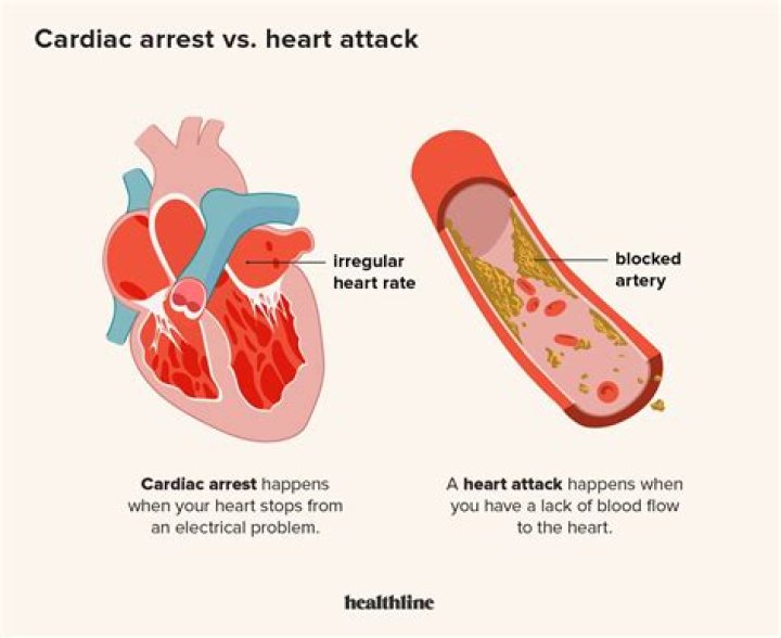What is cardiac arrest vs heart attack?