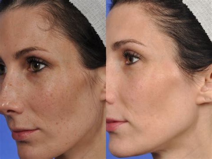 Whats clear and brilliant?