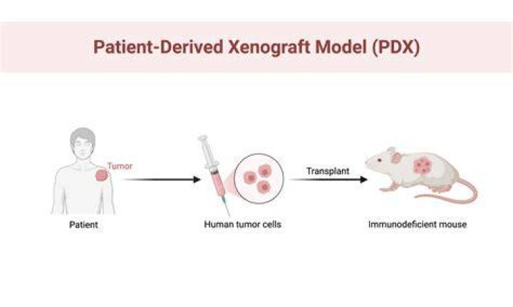 Where is patient derived from?