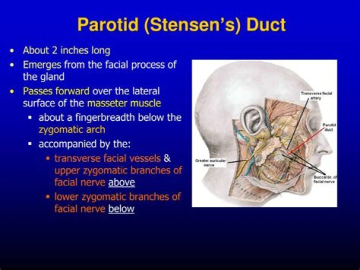 Where is the stensen duct located?
