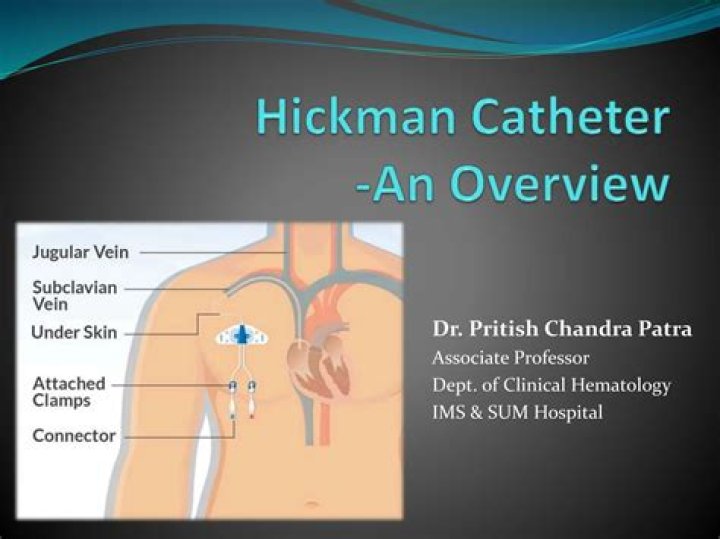 Why is a hickman line used?